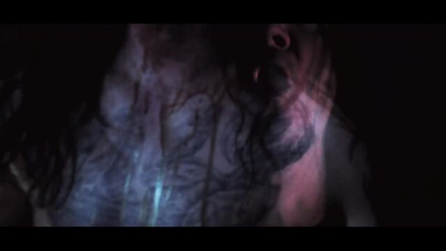 SUTURE - Carcinoma Contagion
