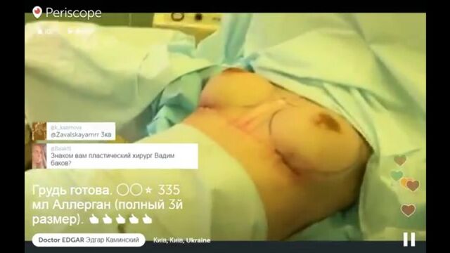 Доктор Эдгар презентует грудь третьего размера