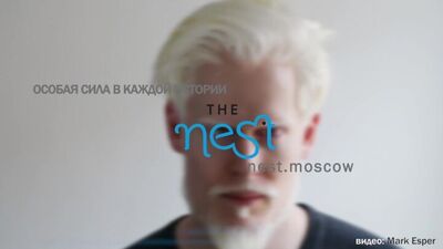 Актер и модель-альбинос Стивен Томпсон поддержал наш проект The NEST