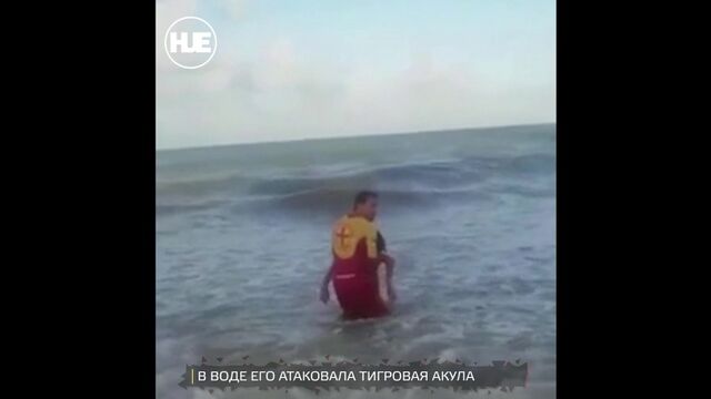 В Бразилии погиб мальчик, которому акула откусила пенис