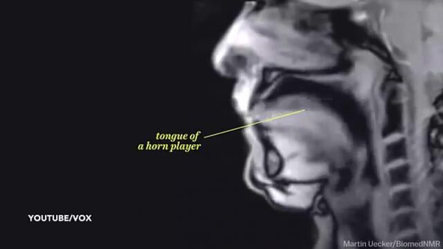 Amazing MRI scan video captures couple having sex