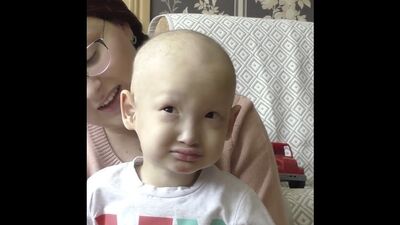 3-летний житель Приморского края просит подарить ему зубки